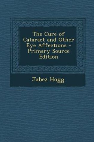 Cover of The Cure of Cataract and Other Eye Affections - Primary Source Edition