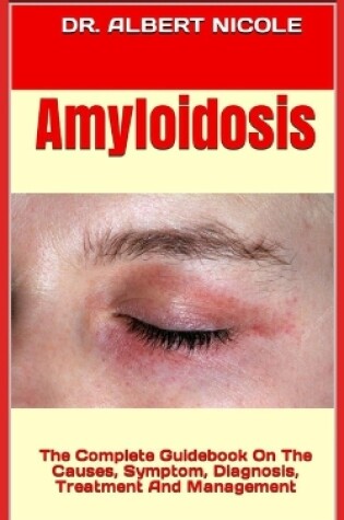 Cover of Amyloidosis