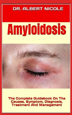 Book cover for Amyloidosis