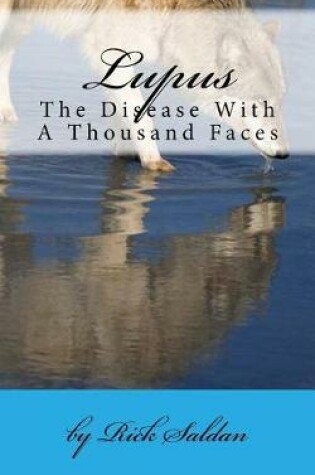 Cover of Lupus, the Disease with a Thousand Faces