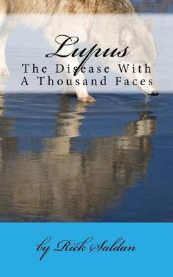 Book cover for Lupus, the Disease with a Thousand Faces