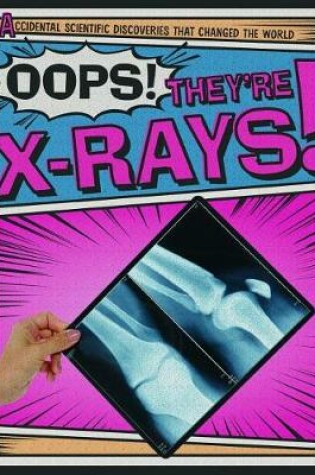 Cover of Oops! They're X-Rays!