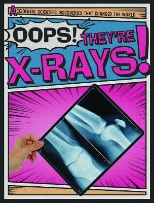 Cover of Oops! They're X-Rays!