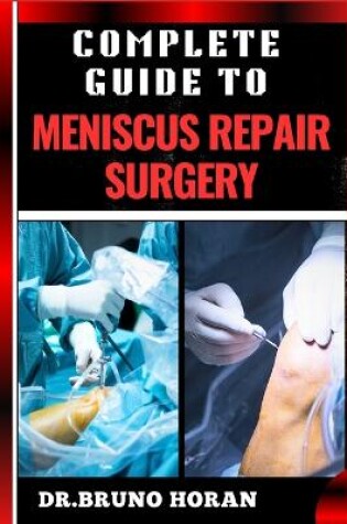 Cover of Complete Guide to Meniscus Repair Surgery