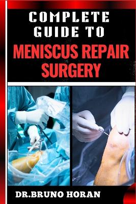 Book cover for Complete Guide to Meniscus Repair Surgery