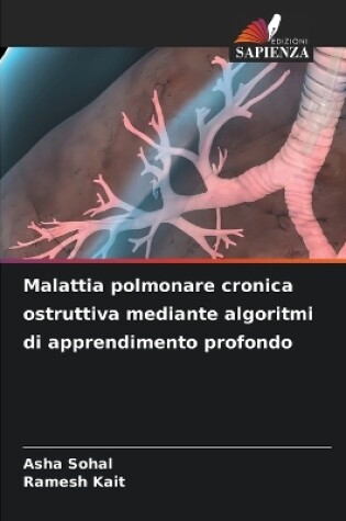 Cover of Malattia polmonare cronica ostruttiva mediante algoritmi di apprendimento profondo