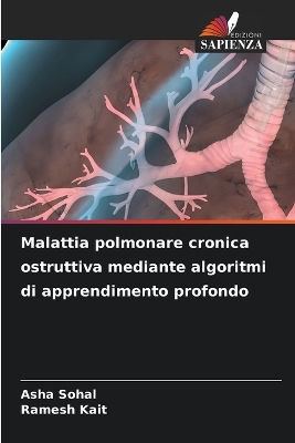 Book cover for Malattia polmonare cronica ostruttiva mediante algoritmi di apprendimento profondo