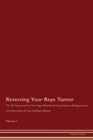 Cover of Reversing Your Reye Tumor