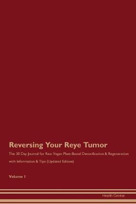 Book cover for Reversing Your Reye Tumor