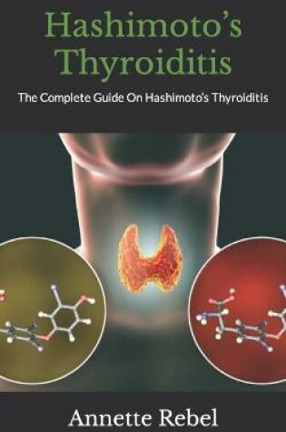 Cover of Hashimoto's Thyroiditis