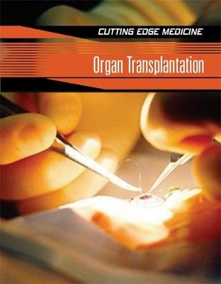 Book cover for Organ Transplantation