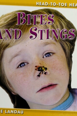 Cover of Bites and Stings