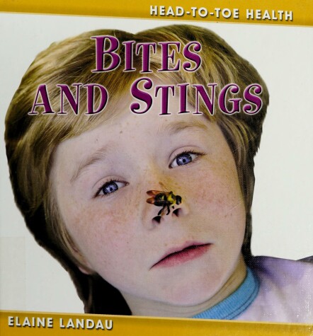 Book cover for Bites and Stings