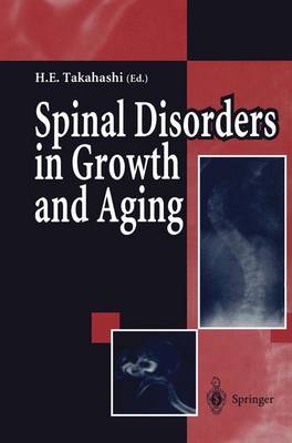 Book cover for Spinal Disorders in Growth and Aging