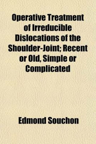 Cover of Operative Treatment of Irreducible Dislocations of the Shoulderjoint, Recent or Old, Simple or Complicated; Recent or Old, Simple or Complicated