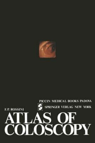 Cover of Atlas of Coloscopy