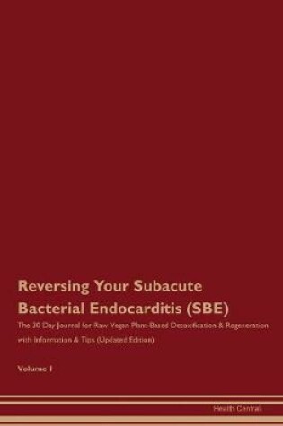 Cover of Reversing Your Subacute Bacterial Endocarditis (SBE)