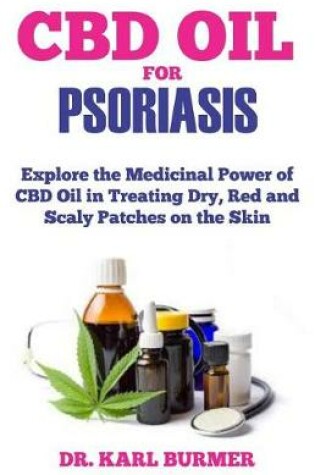 Cover of CBD Oil for Psoriasis