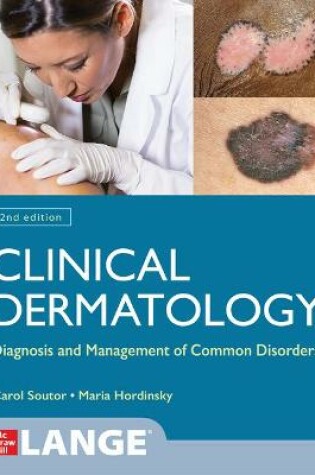 Cover of Clinical Dermatology: Diagnosis and Management of Common Disorders, Second Edition