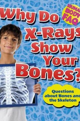 Cover of Why Do X-Rays Show Your Bones?