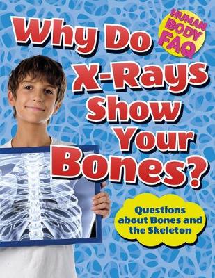 Book cover for Why Do X-Rays Show Your Bones?