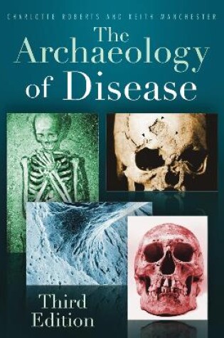 Cover of The Archaeology of Disease