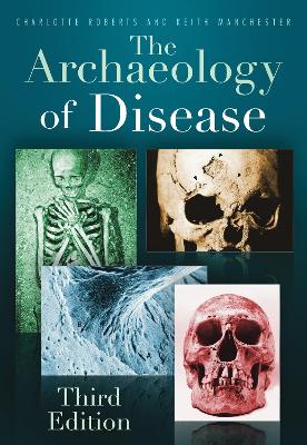 Book cover for The Archaeology of Disease