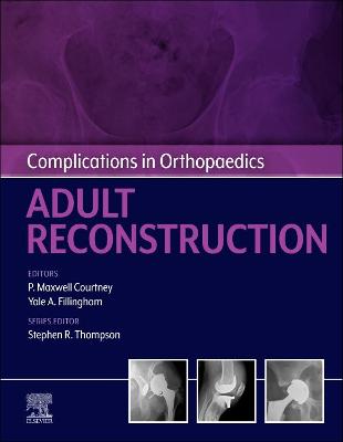 Cover of Complications in Orthopaedics: Adult Reconstruction - E-Book
