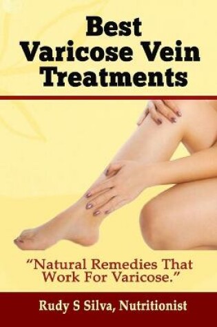 Cover of Best Varicose Vein Treatments