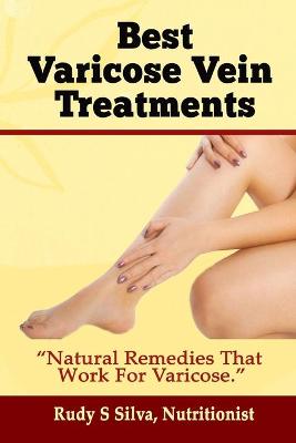 Book cover for Best Varicose Vein Treatments