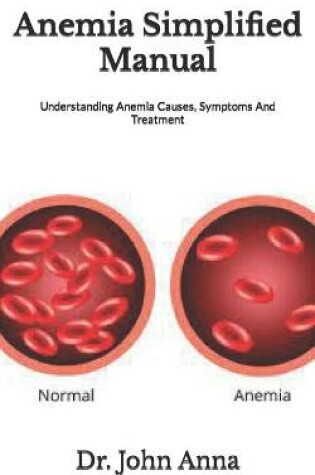 Cover of Anemia Simplified Manual