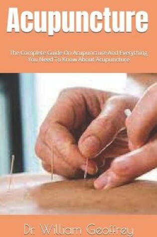 Cover of Acupuncture