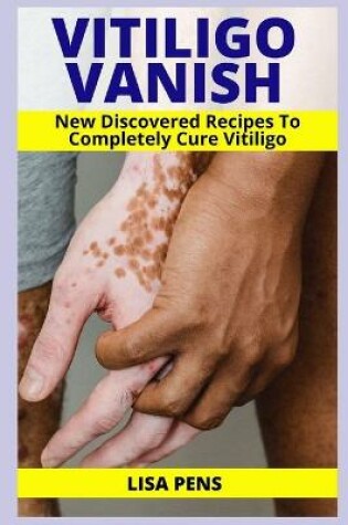 Cover of Vitiligo Vanish