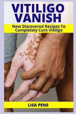 Book cover for Vitiligo Vanish