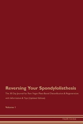 Book cover for Reversing Your Spondylolisthesis