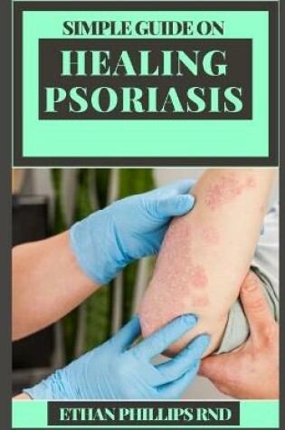 Cover of Simple Guide on Healing Psoriasis