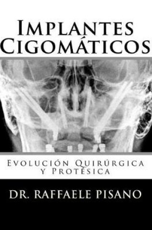 Cover of Implantes Cigomáticos