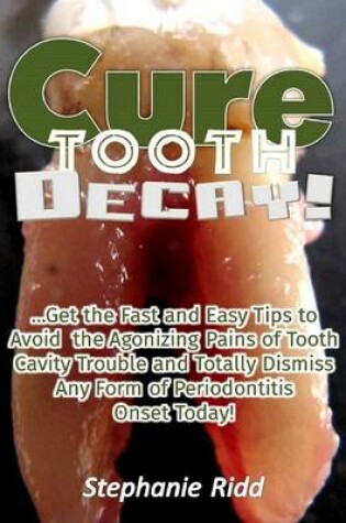 Cover of Cure Tooth Decay! : Get the Fast and Easy Tips to Avoid the Agonizing Pains of Tooth Cavity Trouble and Totally Dismiss Any Form of Periodontitis Onset Today!