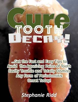 Book cover for Cure Tooth Decay! : Get the Fast and Easy Tips to Avoid the Agonizing Pains of Tooth Cavity Trouble and Totally Dismiss Any Form of Periodontitis Onset Today!