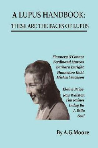 Cover of A Lupus Handbook