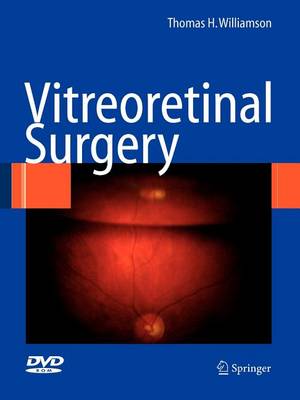 Cover of Vitreoretinal Surgery