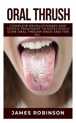 Book cover for Oral Thrush