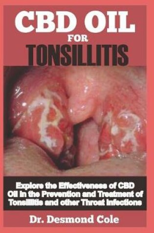 Cover of Tonsillitis