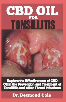 Book cover for Tonsillitis