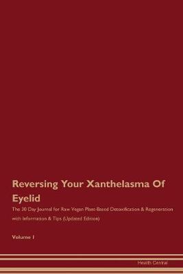 Book cover for Reversing Your Xanthelasma Of Eyelid