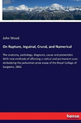 Cover of On Rupture, Inguinal, Crural, and Numerical