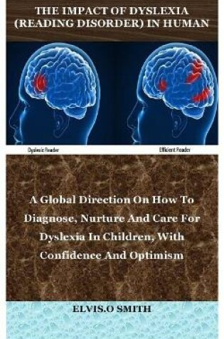Cover of The Impact of Dyslexia (Reading Disorder) in Human