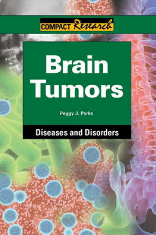 Cover of Brain Tumors