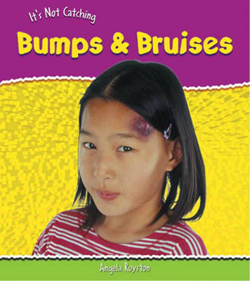Book cover for It's Not Catching: Bumps And Bruises