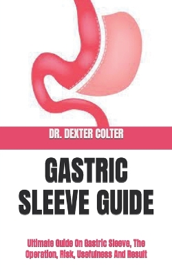 Cover of Gastric Sleeve Guide